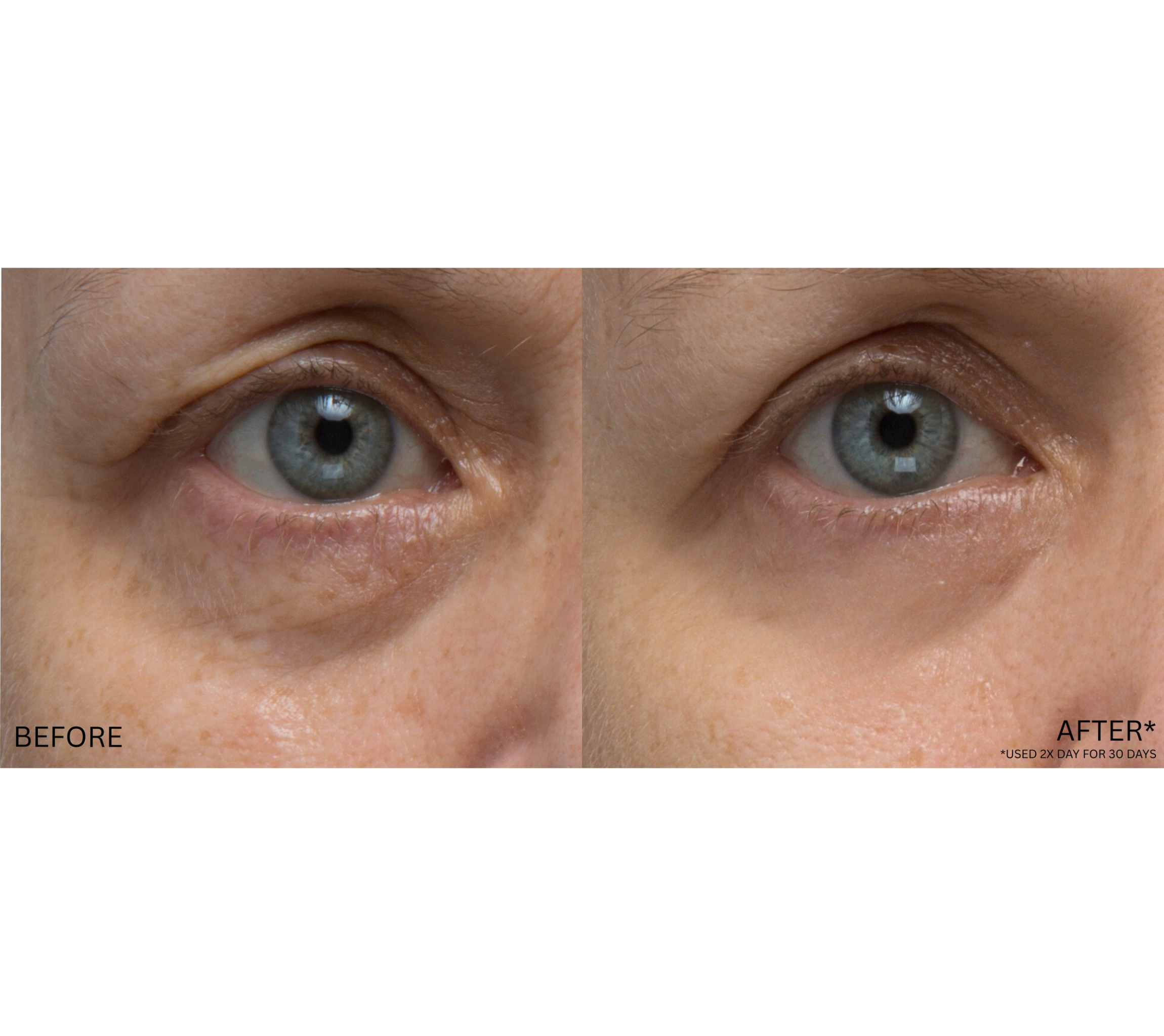 Anti-Puff Eye Cream