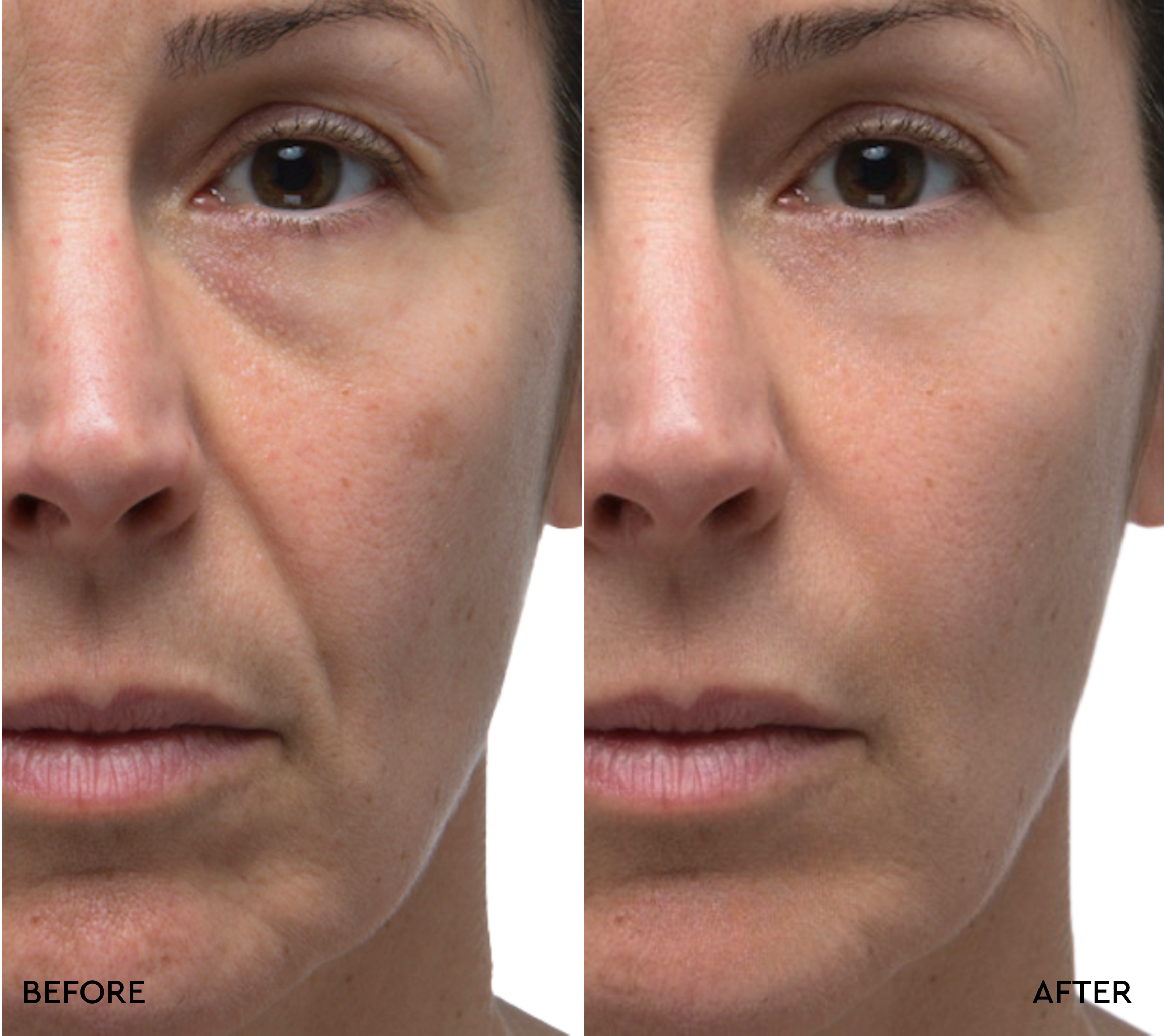 Retinol Rescue Overnight Cream