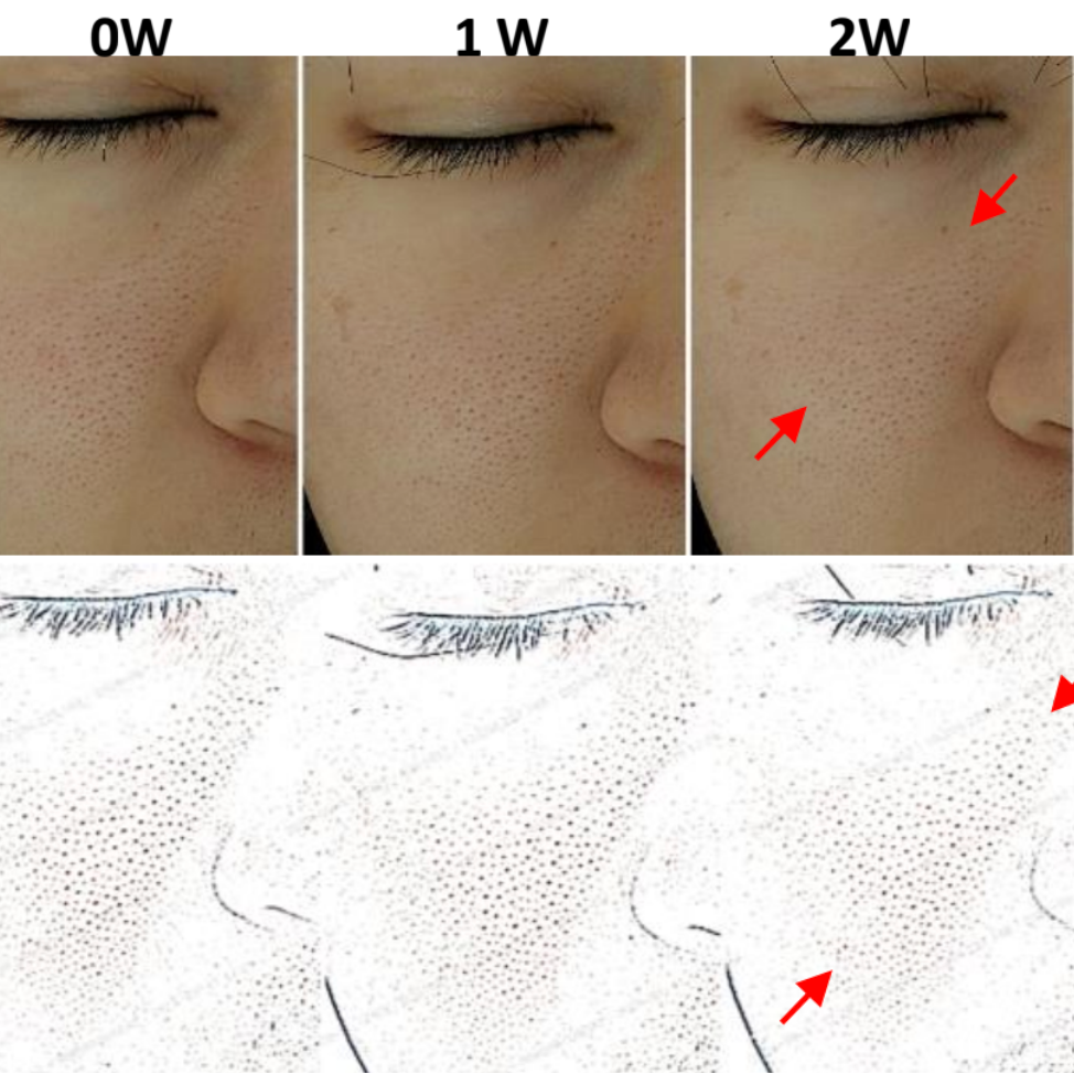 DNA-42 Clinicalift Serum™