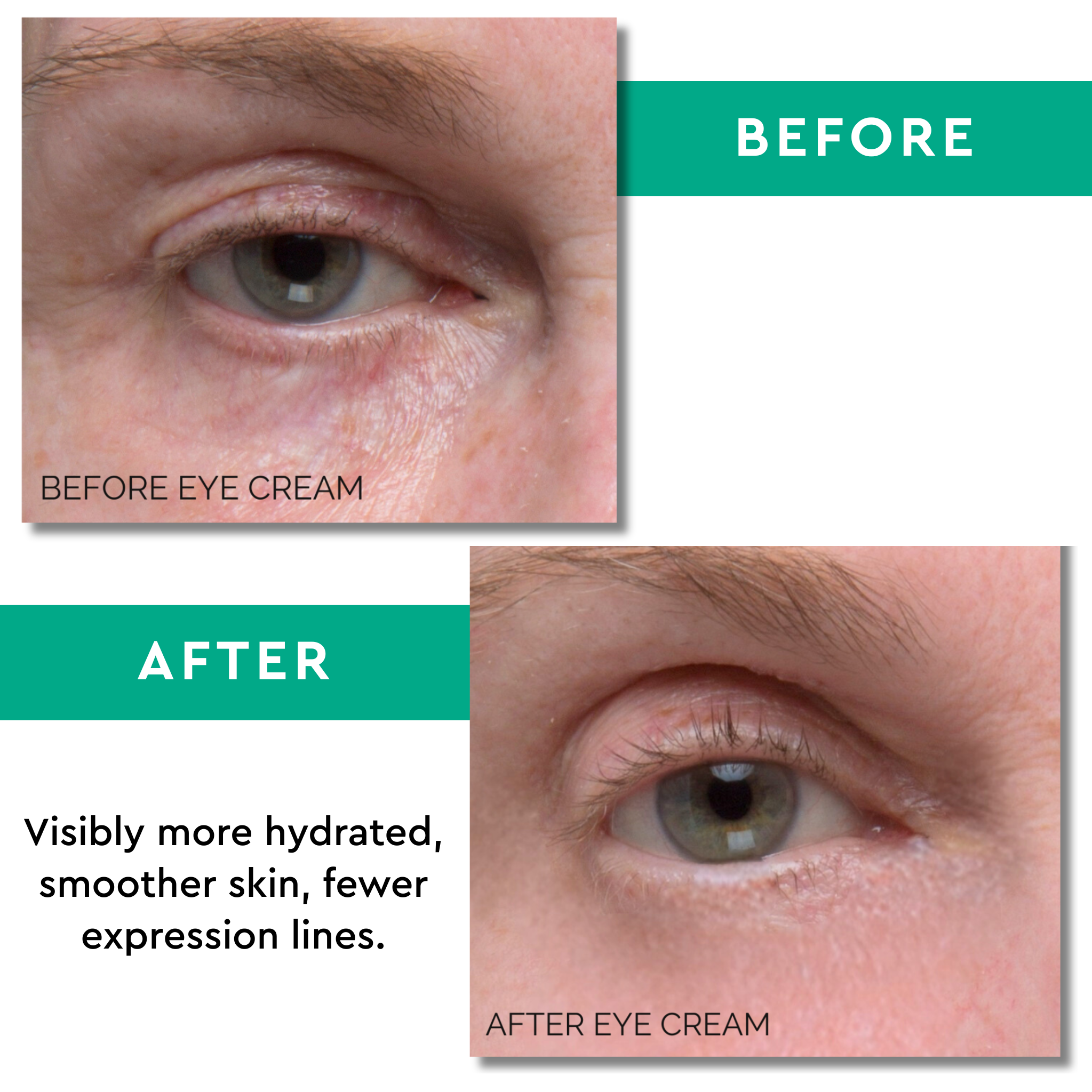 Anti-Puff Eye Cream