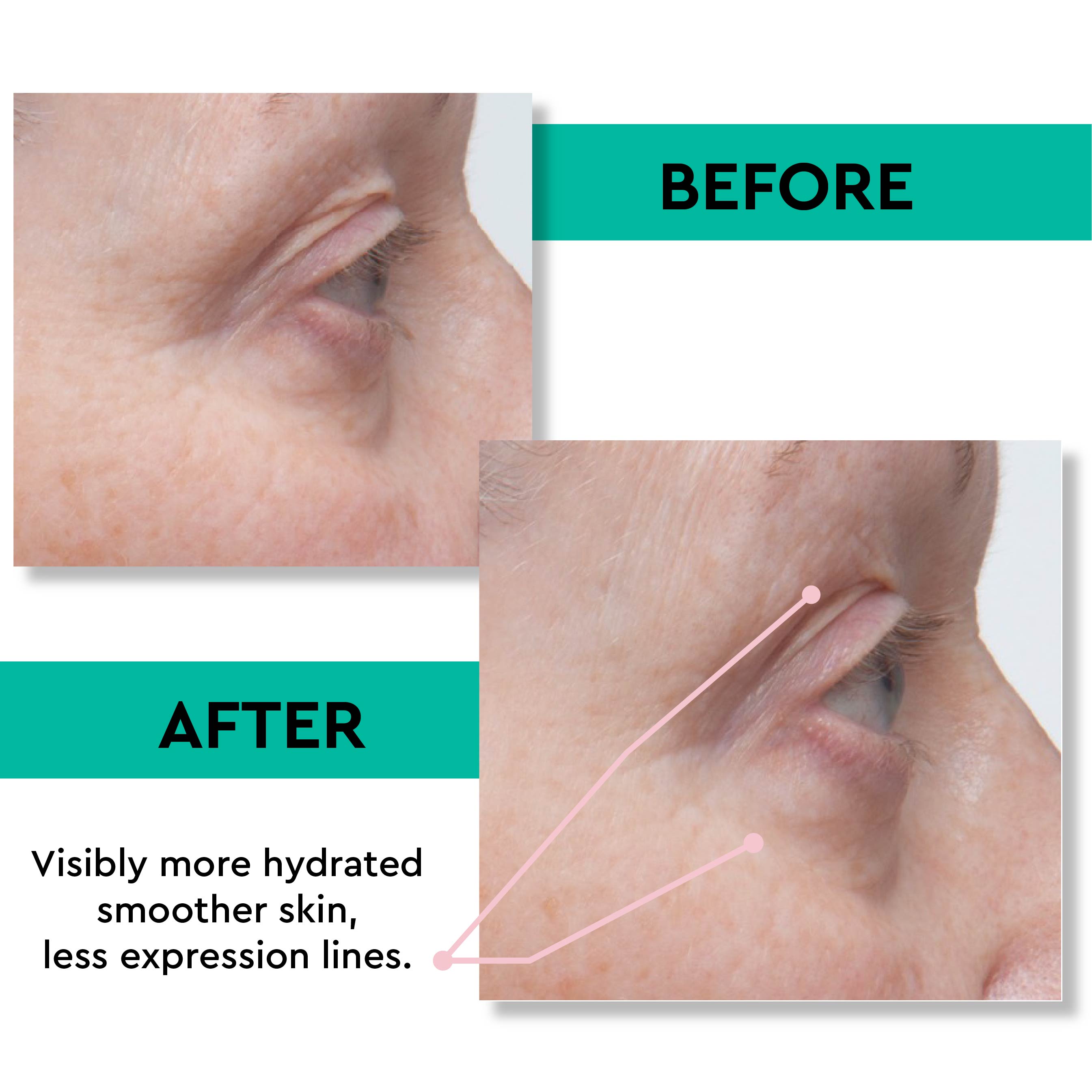 Anti-Puff Eye Cream 20.00% Off Auto renew