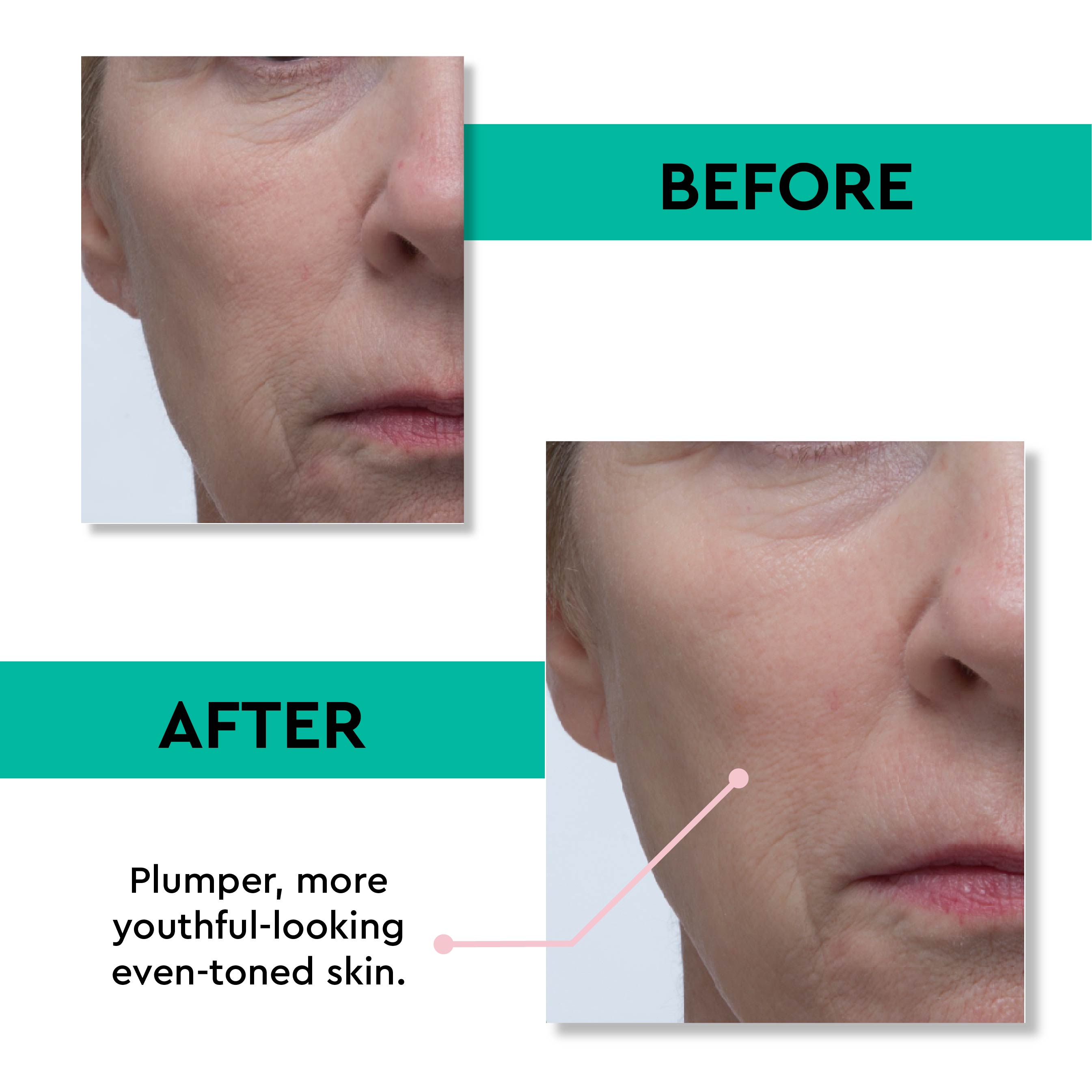 Before - After results using Retinol Rescue Overnight Cream