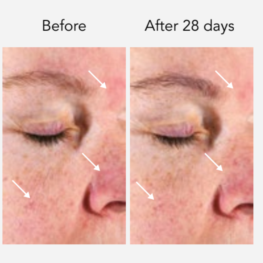 DNA-42 Clinicalift Serum™